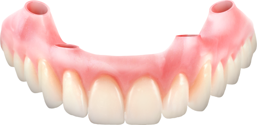3D Printed Gums