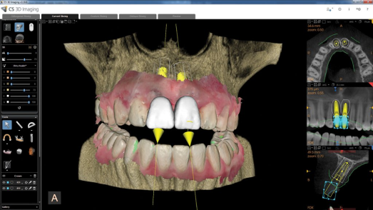 CT Scan Image