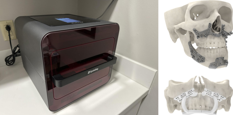 SprintRay